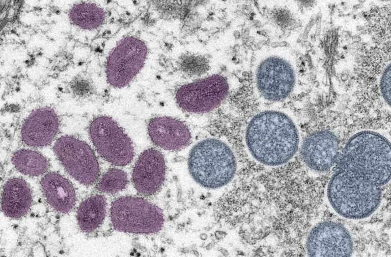 Viruela símica (mpox): Todo lo que necesitas saber sobre sus síntomas y más